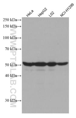EPHX1 Mouse Monoclonal Antibody, Proteintech:Antibodies:Primary Antibodies
