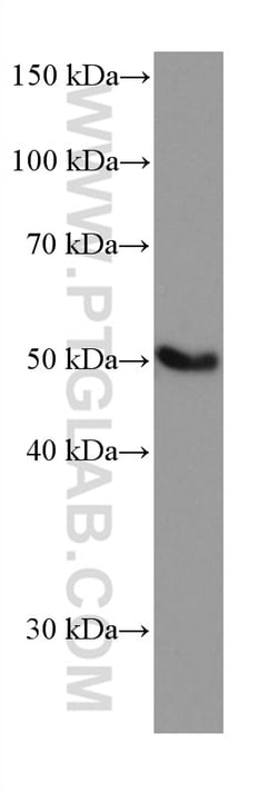 EPHX1 Mouse Monoclonal Antibody, Proteintech:Antibodies:Primary Antibodies