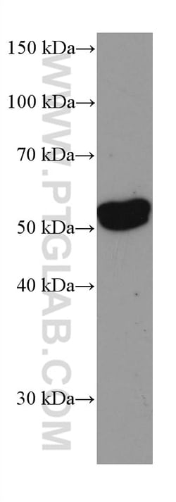 EPHX1 Mouse Monoclonal Antibody, Proteintech:Antibodies:Primary Antibodies