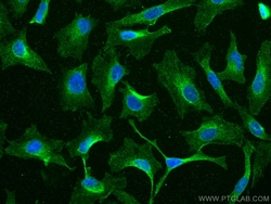 EPRS Mouse Monoclonal Antibody, Proteintech Unconjugated; 150 &mu;L:Antibodies,