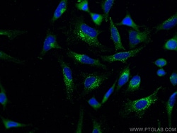 EPRS Mouse Monoclonal Antibody, Proteintech Unconjugated; 150 &mu;L:Antibodies,