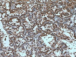 EPRS Mouse Monoclonal Antibody, Proteintech Unconjugated; 150 &mu;L:Antibodies,