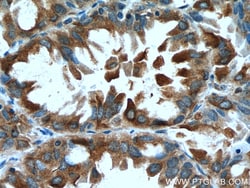 EPRS Mouse Monoclonal Antibody, Proteintech Unconjugated; 150 &mu;L:Antibodies,