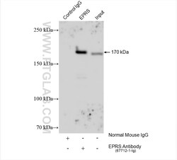 EPRS Mouse Monoclonal Antibody, Proteintech Unconjugated; 150 &mu;L:Antibodies,
