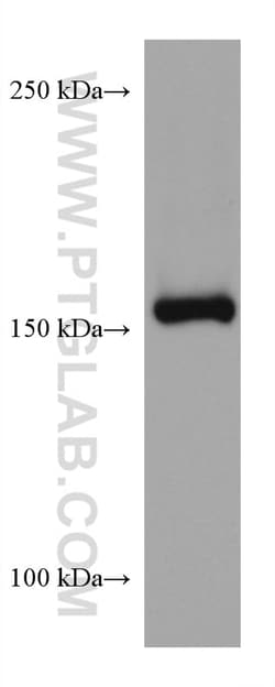 EPRS Mouse Monoclonal Antibody, Proteintech Unconjugated; 150 &mu;L:Antibodies,