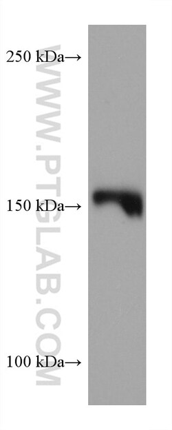 EPRS Mouse Monoclonal Antibody, Proteintech Unconjugated; 150 &mu;L:Antibodies,