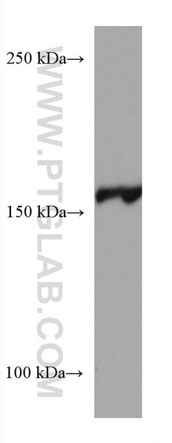 EPRS Mouse Monoclonal Antibody, Proteintech Unconjugated; 150 &mu;L:Antibodies,