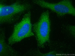 EPS8L2 Mouse Monoclonal Antibody, Proteintech:Antibodies:Primary Antibodies