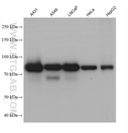 EPS8L2 Mouse Monoclonal Antibody, Proteintech:Antibodies:Primary Antibodies