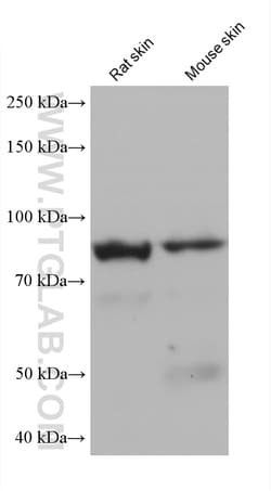 EPS8L2 Mouse Monoclonal Antibody, Proteintech:Antibodies:Primary Antibodies