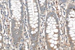 ERAL1 Rabbit Polyclonal Antibody, Proteintech:Antibodies:Primary Antibodies