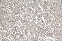 ERAL1 Rabbit Polyclonal Antibody, Proteintech:Antibodies:Primary Antibodies