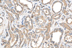 ERAL1 Rabbit Polyclonal Antibody, Proteintech:Antibodies:Primary Antibodies