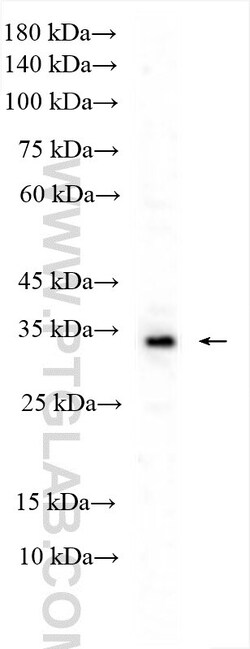 ERAL1 Rabbit Polyclonal Antibody, Proteintech:Antibodies:Primary Antibodies