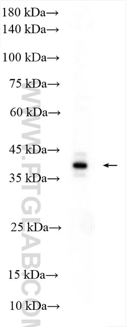 ERAL1 Rabbit Polyclonal Antibody, Proteintech:Antibodies:Primary Antibodies