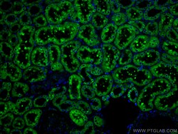 ERP29 Mouse Monoclonal Antibody, Proteintech:Antibodies:Primary Antibodies