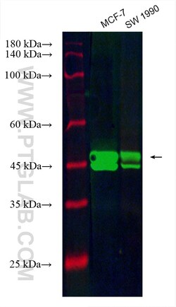 CoraLite Plus 488-conjugated ESR2 Mouse Monoclonal Antibody, Proteintech