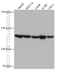 ESYT1 Mouse Monoclonal Antibody, Proteintech:Antibodies:Primary Antibodies