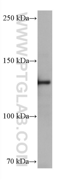 ESYT1 Mouse Monoclonal Antibody, Proteintech:Antibodies:Primary Antibodies