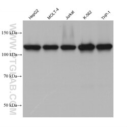 ESYT1 Mouse Monoclonal Antibody, Proteintech:Antibodies:Primary Antibodies