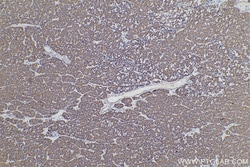 ETFA Mouse Monoclonal Antibody, Proteintech Unconjugated; 20 &mu;L:Anticorps,