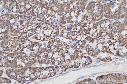 ETFA Mouse Monoclonal Antibody, Proteintech Unconjugated; 20 &mu;L:Anticorps,