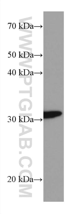 ETFA Mouse Monoclonal Antibody, Proteintech Unconjugated; 20 &mu;L:Anticorps,