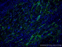 CoraLite Plus 488-conjugated Endoglin/CD105 Mouse Monoclonal Antibody, Proteintech 20 &mu;L | Buy Online | Proteintech | Fisher Scientific