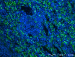 F4/80 Rabbit Polyclonal Antibody, Proteintech Unconjugated; 150 &mu;L:Antibodies,