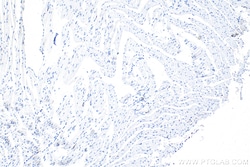 F4/80 Rabbit Polyclonal Antibody, Proteintech Unconjugated; 150 &mu;L:Antibodies,