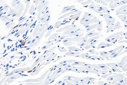 F4/80 Rabbit Polyclonal Antibody, Proteintech Unconjugated; 150 &mu;L:Antibodies,