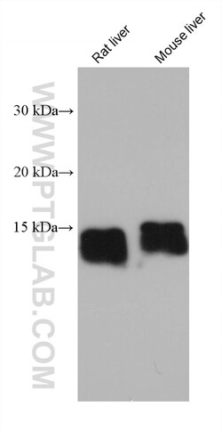 FABP1 Mouse Monoclonal Antibody, Proteintech Unconjugated; 150 &mu;L:Antibodies,