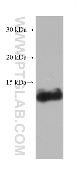 FABP1 Mouse Monoclonal Antibody, Proteintech Unconjugated; 150 &mu;L:Antibodies,