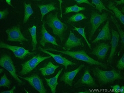 CoraLite Plus 488-conjugated FABP5 Rabbit Polyclonal Antibody, Proteintech:Antibodies:Primary