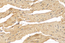 FADS2 Rabbit Polyclonal Antibody, Proteintech:Anticuerpos:Anticuerpos primarios
