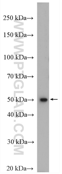 FADS2 Rabbit Polyclonal Antibody, Proteintech:Anticuerpos:Anticuerpos primarios