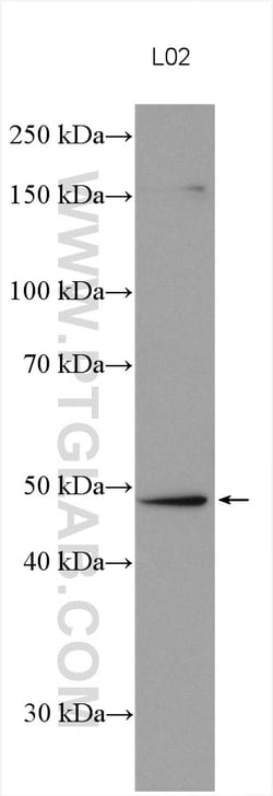 FADS2 Rabbit Polyclonal Antibody, Proteintech:Anticuerpos:Anticuerpos primarios