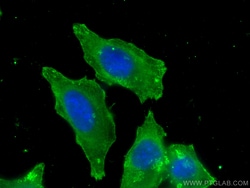 FAH Mouse Monoclonal Antibody, Proteintech:Antibodies:Primary Antibodies