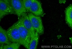 FAH Mouse Monoclonal Antibody, Proteintech:Antibodies:Primary Antibodies