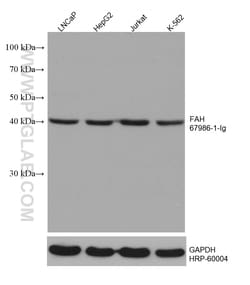 FAH Mouse Monoclonal Antibody, Proteintech:Antibodies:Primary Antibodies