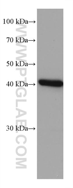 FAH Mouse Monoclonal Antibody, Proteintech:Antibodies:Primary Antibodies