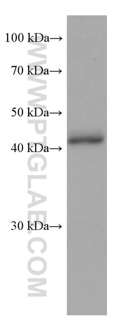 FAH Mouse Monoclonal Antibody, Proteintech:Antibodies:Primary Antibodies