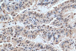 FAM111B Rabbit Polyclonal Antibody, Proteintech Unconjugated; 20 &mu;L:Antibodies,