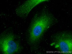 FAM114A2 Rabbit Polyclonal Antibody, Proteintech Unconjugated; 150 &mu;L:Antibodies,