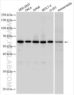 FAM114A2 Rabbit Polyclonal Antibody, Proteintech Unconjugated; 150 &mu;L:Antibodies,
