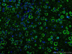 FAM135B Rabbit Polyclonal Antibody, Proteintech:Antibodies:Primary Antibodies