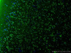 FAM135B Rabbit Polyclonal Antibody, Proteintech:Antibodies:Primary Antibodies