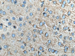 FAM135B Rabbit Polyclonal Antibody, Proteintech:Antibodies:Primary Antibodies