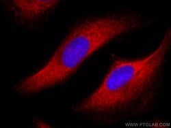 FASN Mouse anti-Human, CoraLite 594, Clone: 1B6E4, Proteintech:Antibodies:Primary