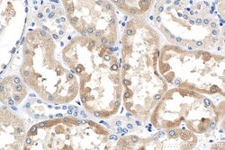 FATP2 Mouse Monoclonal Antibody, Proteintech Unconjugated; 150 &mu;L:Antibodies,